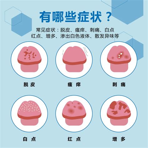 龜頭有一顆一顆|包皮長一粒一粒東西？5 種「陰莖顆粒」可能成因解。